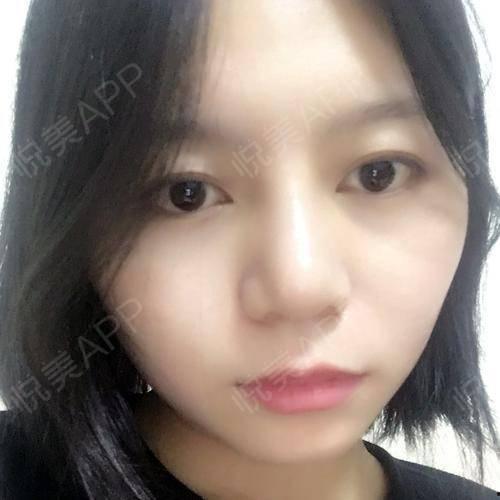 娱乐吃瓜酱不用做鼻子,揭秘明星隐私，不做鼻子也能畅游娱乐圈